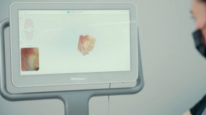 Сканирование зубов при помощи искусственного интеллекта.