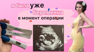 Незапланированная беременность. Что делать? Как повлиял наркоз? Как сказала мужу?