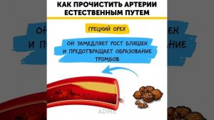 Как прочистить артерии