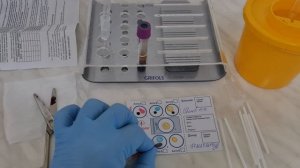 Исследования перед  трансфузией эритроцитной взвеси.