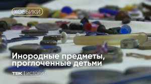 Коллекция инородных предметов, проглоченных детьми / «Хоббики»