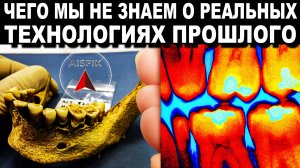 Вот как ДРЕВНИЕ люди ставили СОВРЕМЕННЫЕ зубные пломбы 3000 лет назад