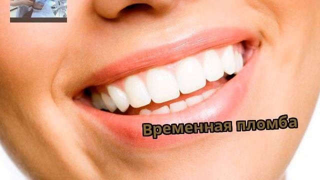 Временная пломба