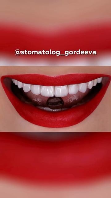 За улыбкой мечты - ко мне! Королева винир - Анна Гордеева