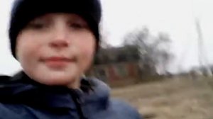 У Сони болит нога из-за корсаров