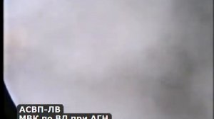 Испытания АСВП-ЛВ во ФГУП ЦНИИМАШ, 2004г.