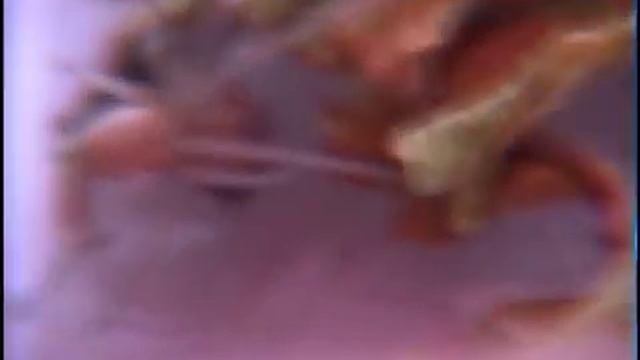 miturgidae....... смотреть онлайн