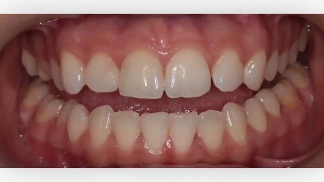 Первая встреча с нашими пациентами смотреть онлайн