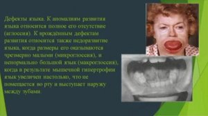 Жилова Ю.П. Патология органов речи