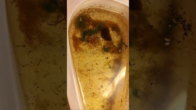 Личинки Комара підвального, Де Вони Живуть? Що Це за Комарі? Кусаються?