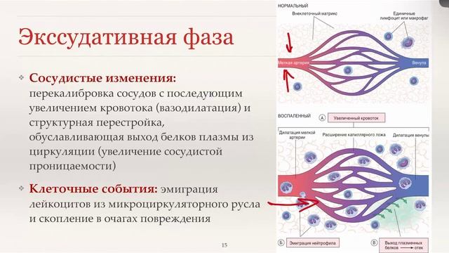4 Патология. Воспаление