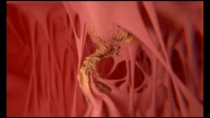 Алкоголь_и_сердце