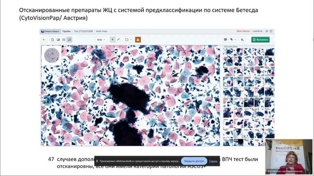 Кольпоскопия, секреты шейки матки и другие актуальные проблемы гинекологии.