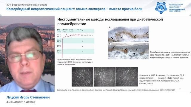 Диагностика и лечение болевой формы диабетической полинейропатии. Д.м.н., доцент Луцкий И.С.