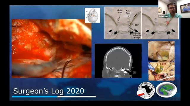 E1S8: Double Up, Double Down (Cavernous Sinus Meningioma) смотреть онлайн