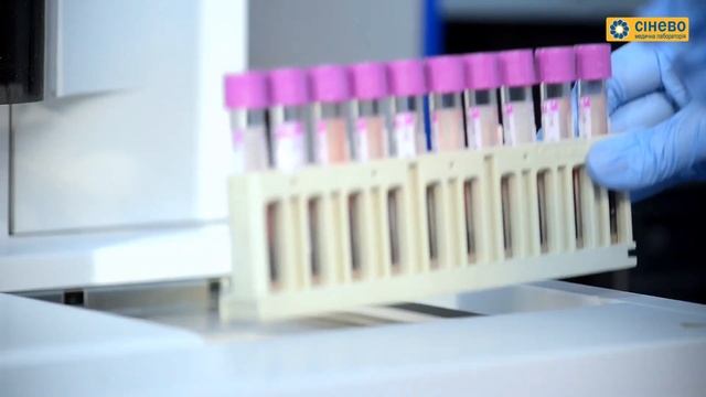 Шлях пробірки в медичній лабораторії «СІНЕВО» смотреть онлайн