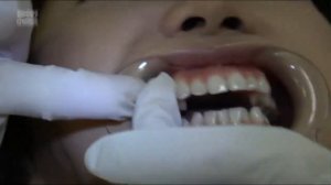 Pretty Girl teeth check up at Dentist