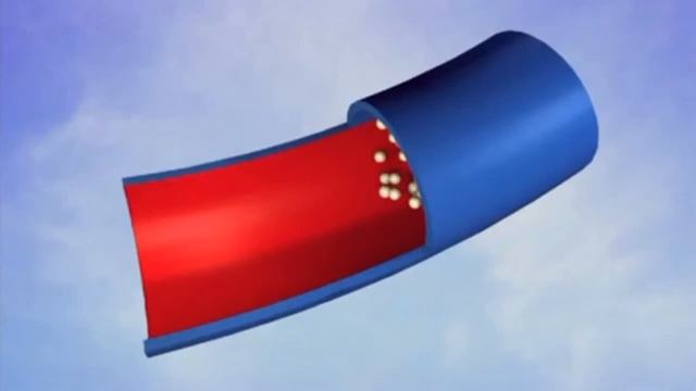 Склеротерапия вен нижних конечностей
