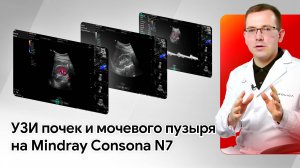 УЗИ почек и мочевого пузыря на Mindray Consona N7. Практический мастер-класс