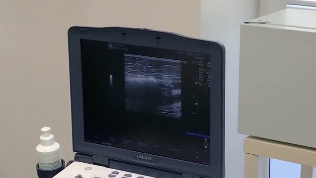АРД КЛИНИК  Эндовенозная лазерная коагуляция большой подкожной вены ЭВЛК БПВ