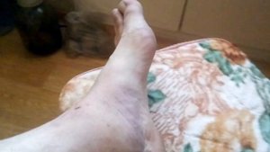 ПРИЛЕТЕЛО ТОПОРОМ ПО НОГЕ.. (КАК В АНЕКДОТЕ ПРО 42 Й)