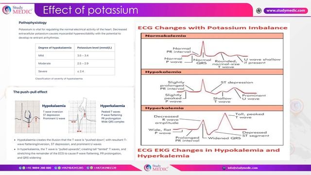 MRCOG Part 1 | KickStart Series | ECG Changes| Dr Chitra Diwan смотреть онлайн