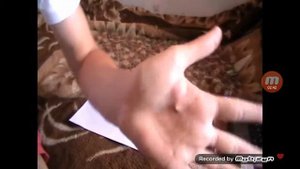 Пацан иголкой проткнул руку