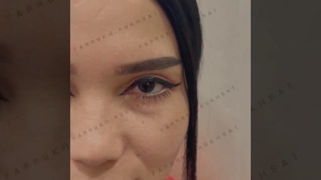 🇺🇿| Друзья после Сангапури 14 день супер результат Без синяков без отеков 👌 смотреть онлайн