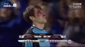 Вратаря избивают мячом