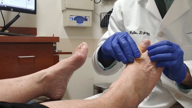 Cortisone Injection For Gout смотреть онлайн