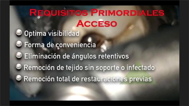 714 Tips para el uso de localizadores apicales смотреть онлайн