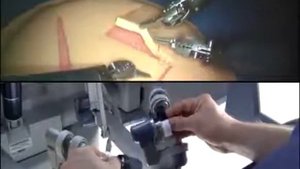 Демонстрация работы робота-хирурга Da Vinci