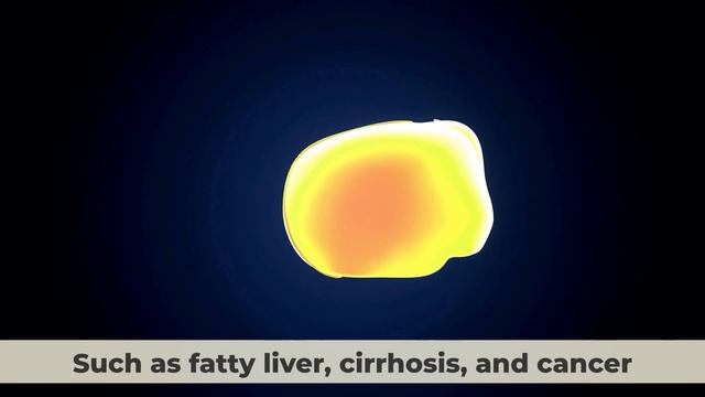 Why You MUST AVOID These 10 Foods At All Costs To Keep Your Liver Healthy смотреть онлайн