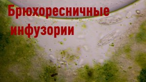 Брюхоресничная инфузория