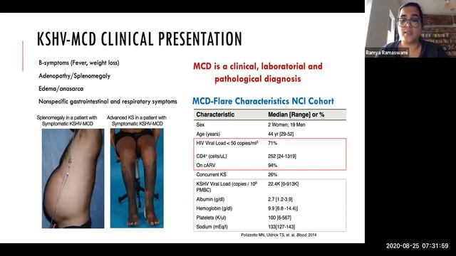 HIV Associated Malignancies Dr Ramaswami смотреть онлайн