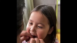 Убираем первый молочный зубик 🦷