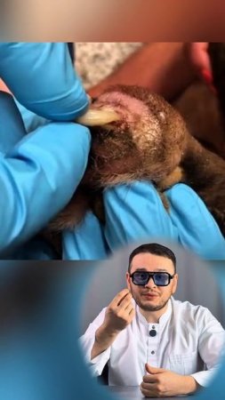 Вросший коготь