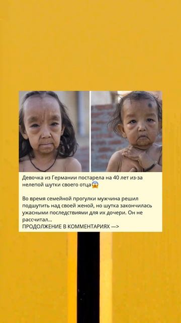 Девочка из Германии постарела на 40 лет из-за нелепой шутки своего отца😱 смотреть онлайн