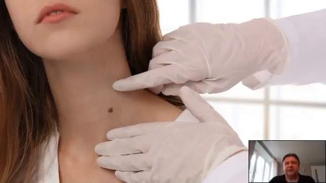 Кожные новообразования, которые портят нам жизнь смотреть онлайн