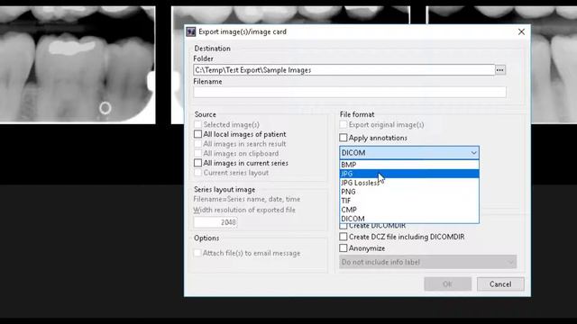 MiPACS 4.0 - Exporting Images смотреть онлайн
