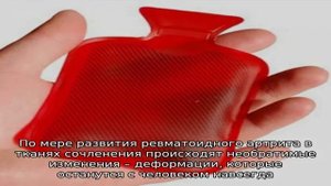Боль в суставах рук