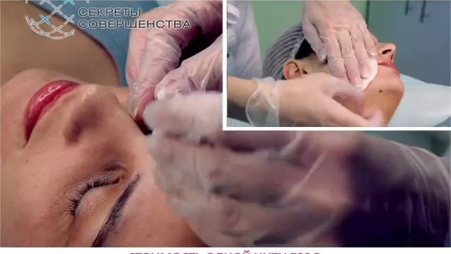 Мезонити в теплых тонах