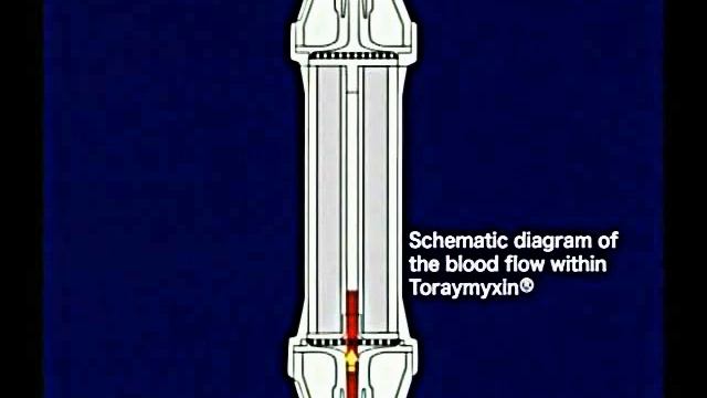 Toraymyxin PMX-20R Radial Flow смотреть онлайн