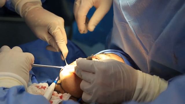 Combination Plastic Surgery Procedure with Premium Care смотреть онлайн