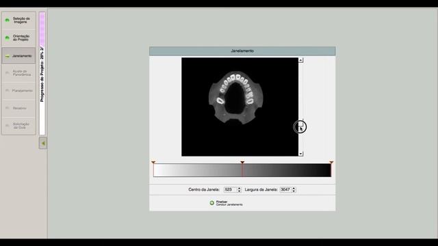 Como importar arquivos DICOM смотреть онлайн