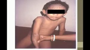 Case Presentation by Dr Subrata Banerjea