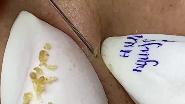 𝐂𝐡𝐢𝐥𝐥 𝐘𝐨𝐮𝐫 𝐋𝐢𝐟𝐞 𝐖𝐢𝐭𝐡 𝐋𝐍𝐆 𝐒𝐤𝐢𝐧 𝐂𝐚𝐫𝐞 # 66697 смотреть онлайн