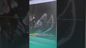 Клинический случай из практики Филиппова Никиты Алексеевича