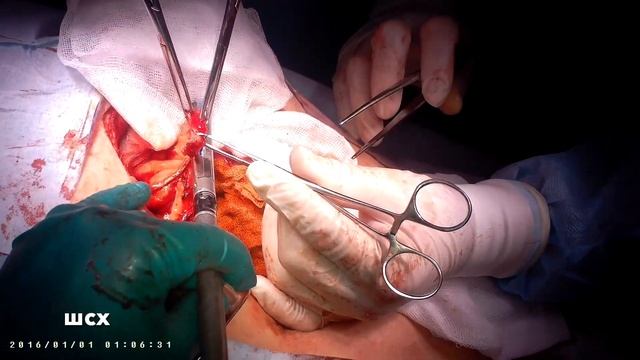 Эвертированный шов смотреть онлайн