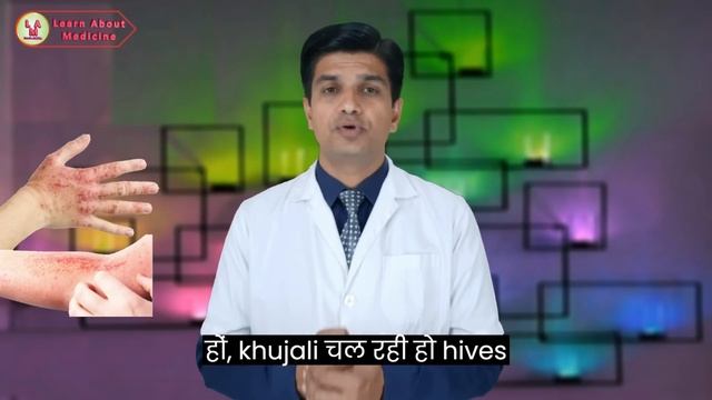 Allergy ki powerful tablet | Desloratadine tablets 5 mg | desloratadie tablets 10 mg смотреть онлайн